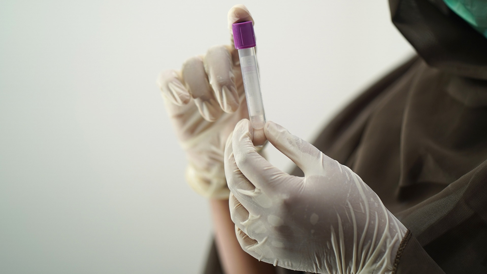 Vial of Blood for a Blood Test