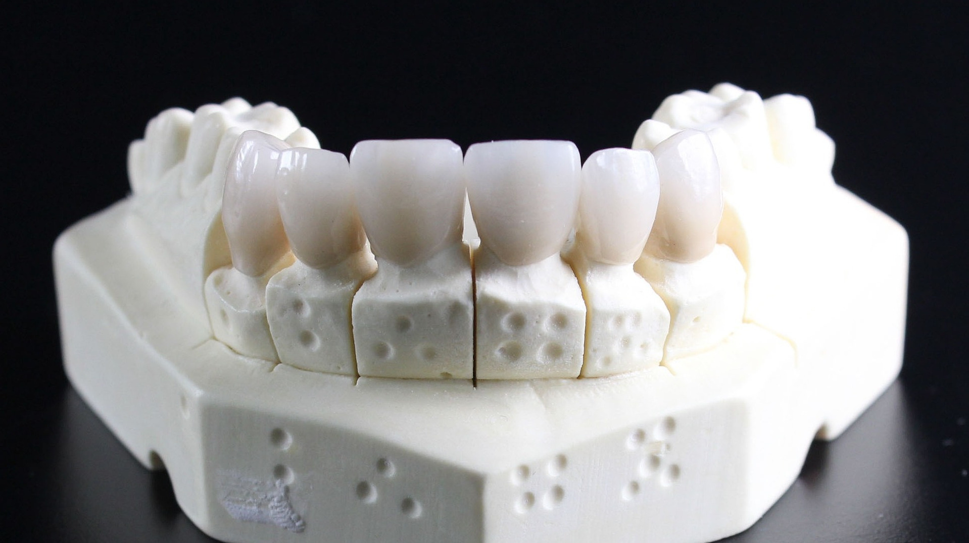 Bottom mold of teeth for dentures