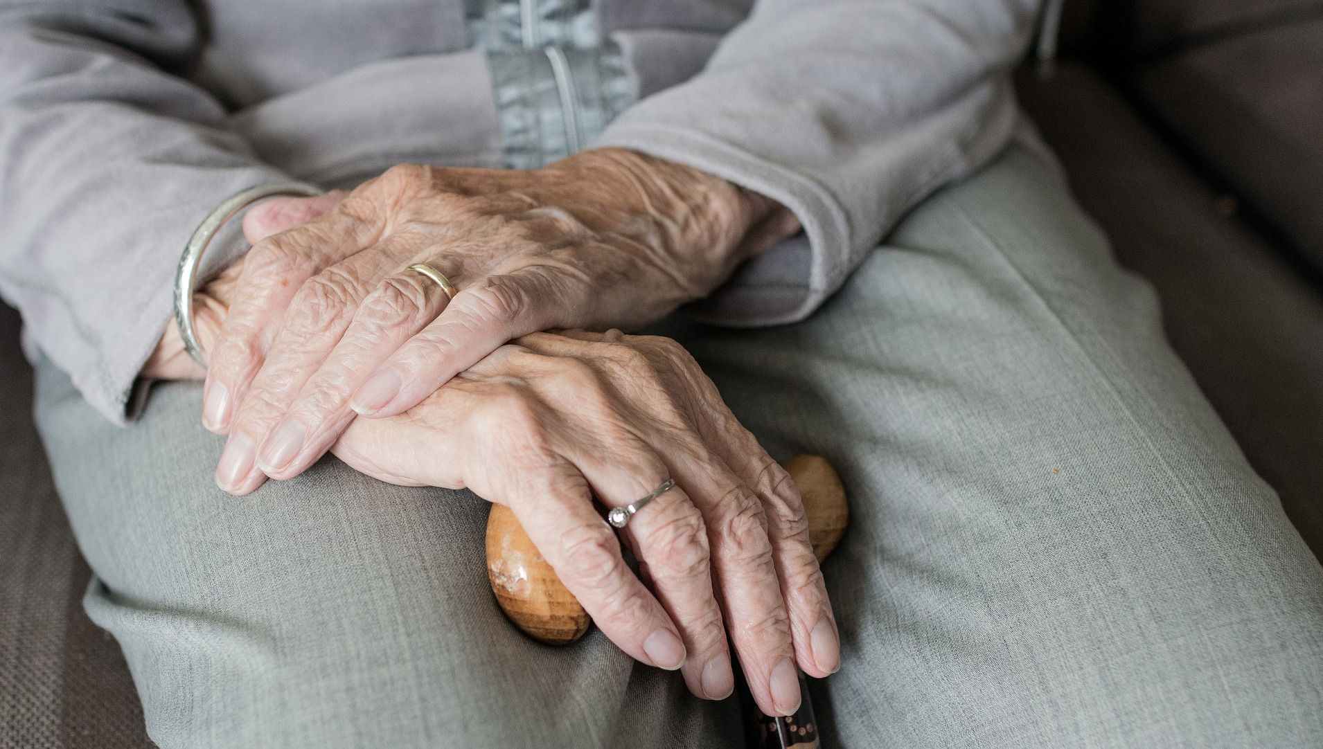 Image of arthritic hands